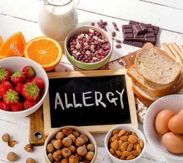 مدیریت آلرژی در صنایع غذایی