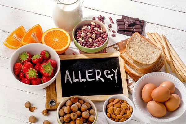 مدیریت آلرژی در صنایع غذایی